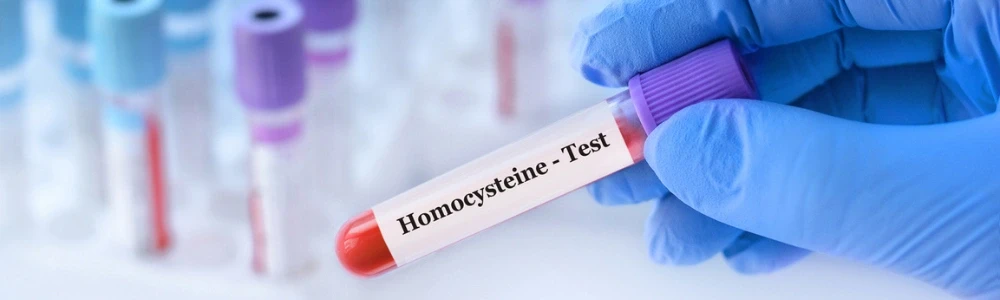 Kas ir homocisteīns un kāpēc tas ir svarīgs veselībai?