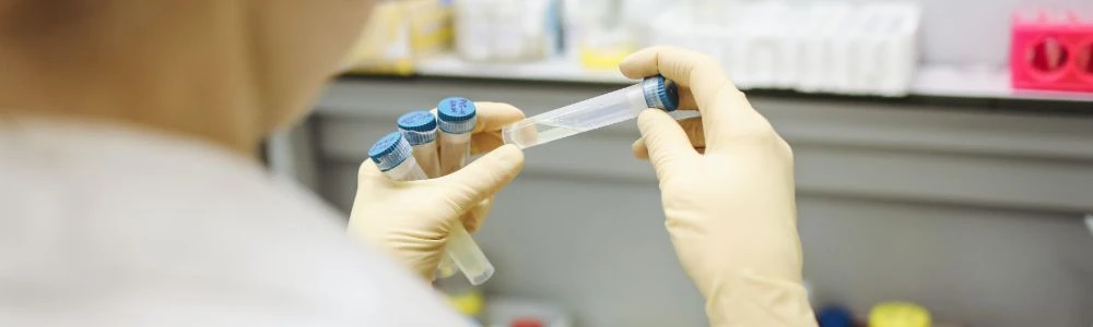 Antigēnu jeb ātrais tests – kādu izvēlēties?
