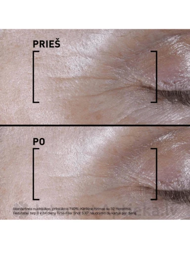 FILORGA TIME FILLER 5 XP SHOT serums, 15 ml | internetaptieka.lv