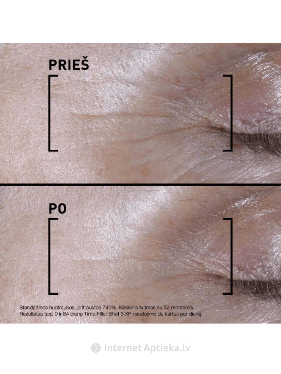 FILORGA TIME FILLER 5 XP SHOT seerum, 15 ml | internetaptieka.lv