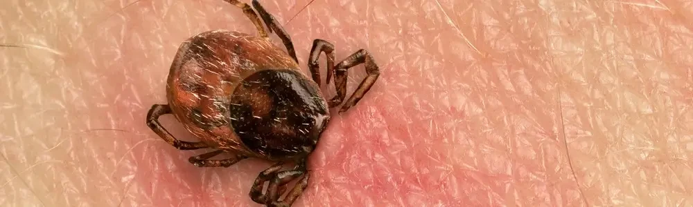 Laimas slimības simptomi: kā atpazīt un kad vērsties pie ārsta?